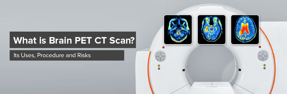 What is Brain PET CT Scan? Its Uses, Procedure and Risks